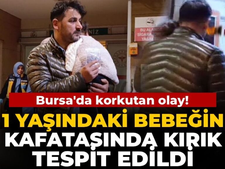 1-yasindaki-bebegin-kafatasinda-kirik-tespit-edildi-NItTkVXF